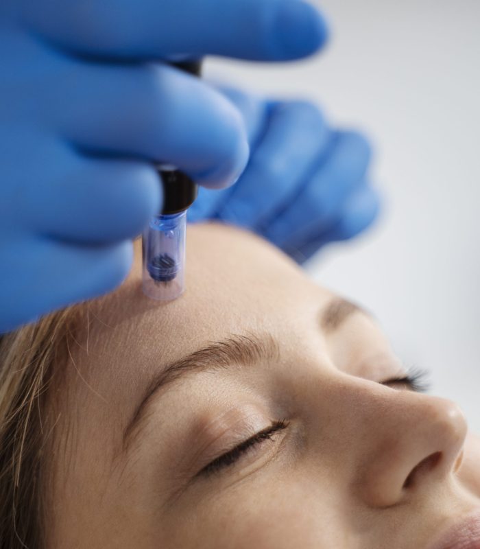 MEZOTERAPIA MIKROIGŁOWA